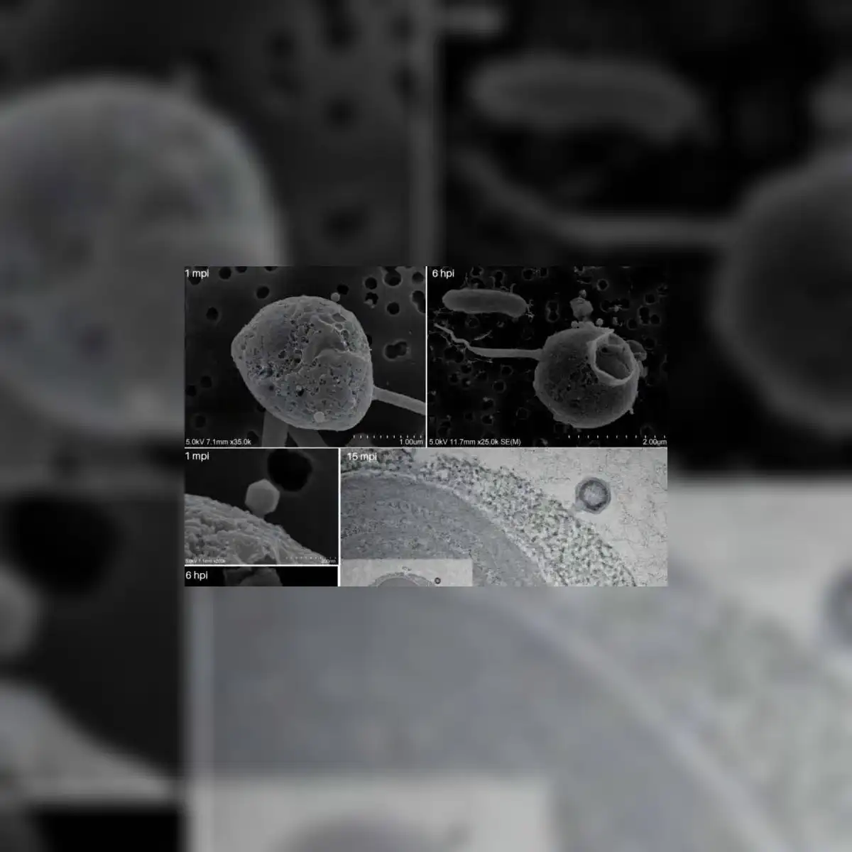 Micrografías SEM y TEM muestran la fijación de la cola en el sistema PelV1 de Pelagodinium durante la infección temprana. Foto: bioRxiv