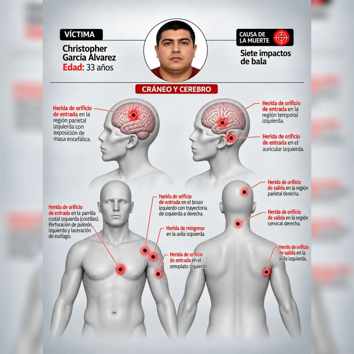 Christopher García Álvarez - siete impactos de bala