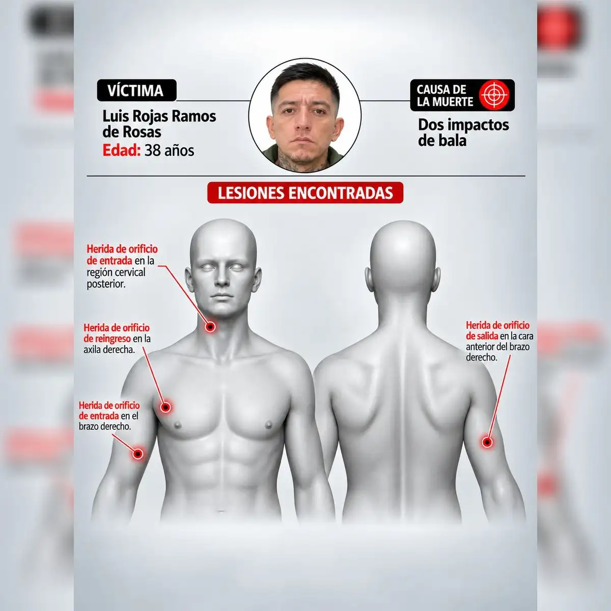 Luis Rojas Ramos - Dos impactos de bala