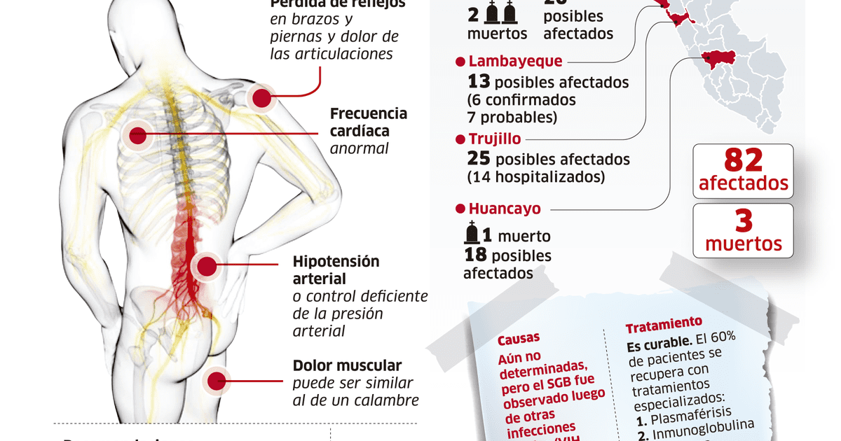 Síntomas Que Manifiesta El Síndrome De Guillain Barré Infografía Sociedad La República 9693