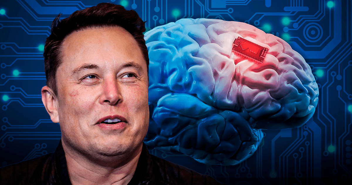 Elon Musk Neuralink Obtiene Permiso Para Implantar Chips En Cerebros