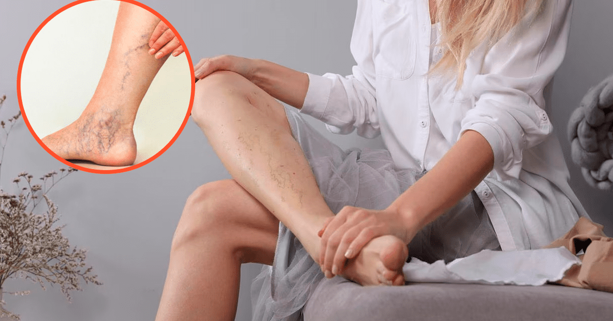 Técnica natural para mejorar la circulación sanguínea en las piernas