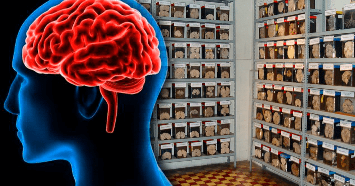 Museo Del Cerebro 2023 En Lima ¿cómo Llegar Y Dónde Queda Revisa La Dirección Horarios Y Más 0695