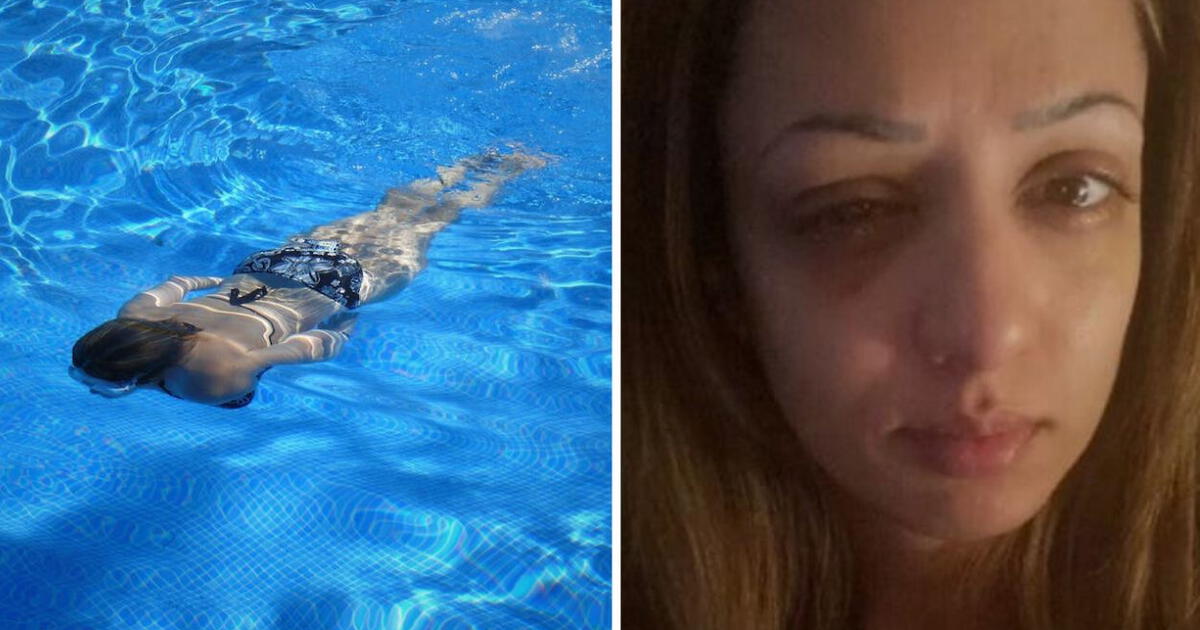 Woman goes swimming in public pool and loses sight in one eye: “The most unbearable pain” |  United Kingdom |  woman infected with amoeba in swimming pool |  VIDEOS |  CDC |  health |  disease |  World