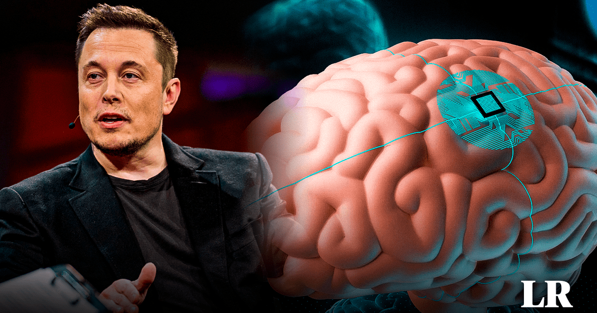 Elon Musk Anuncia Primer Implante Cerebral De Neurolink En Humanos