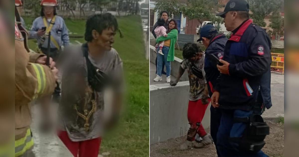Hombre recibe descarga eléctrica y sufre quemaduras graves al intentar ...