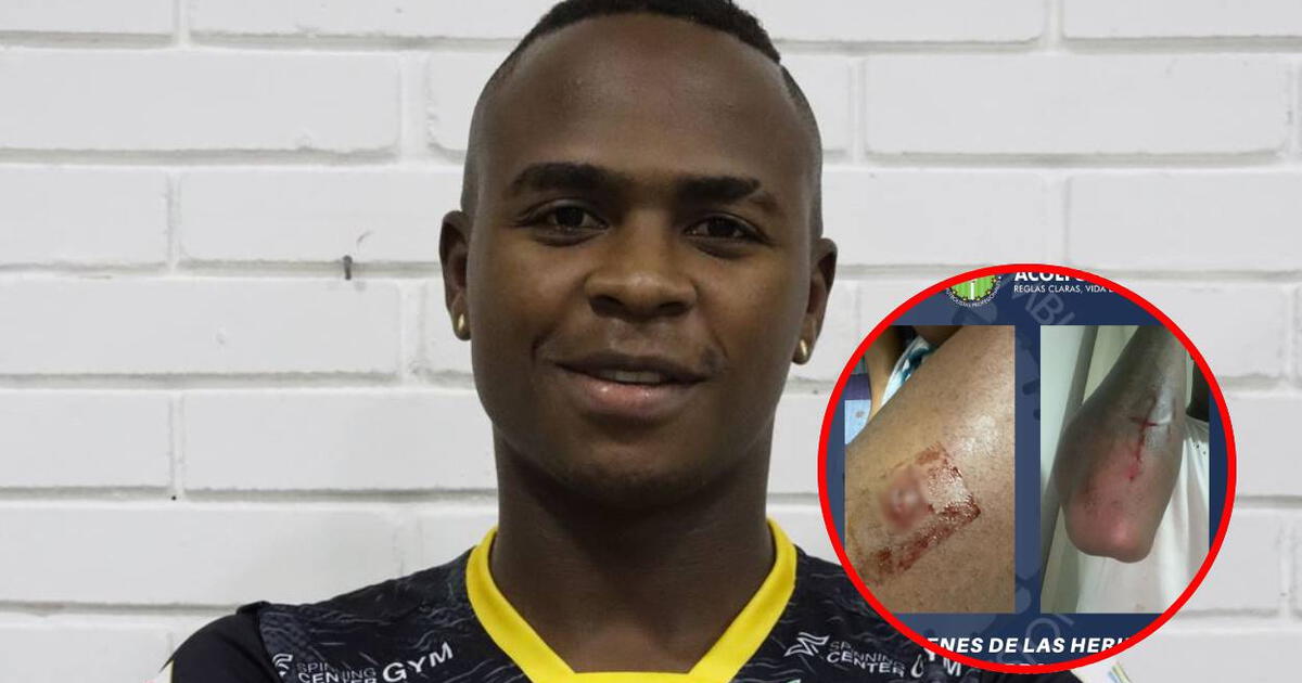 Conmoción en el fútbol colombiano: Brandon Caicedo, jugador de Deportes Quindío, fue apuñalado por barristas del club