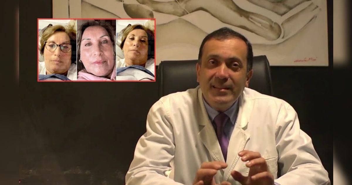 Dina Boluarte: decretos supremos fueron firmados mientras tuvo rostro vendado y con gaza en los ojos tras cirug&iacute;as