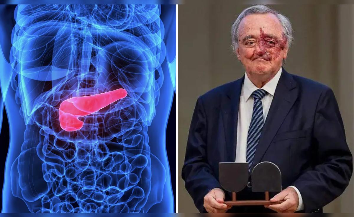 <? htmlspecialchars($article['title_ai']) ?>