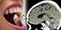 Científicos descubren que las bacterias que habitan en la boca podrían afectar a nuestro cerebro