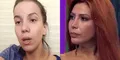Greissy Ortega impacta al reaparecer hospitalizada tras presunto enfrentamiento con Milena Zárate: "Esperamos pueda mejorar"
