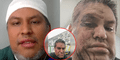 Ingeniero peruano denuncia agresión xenófoba en Chile y paramédicos se niegan a atenderlo a tiempo: "Me dijeron que no podían intervenir"