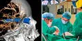 Salvan de morir a niño de 3 años que quedó con un metal incrustado en su cabeza, en San Borja