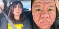 Mujer expone cambio extremo en su rostro durante su embarazo y cómo afectó su autoestima: "No me reconocía"