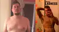 Joven sufrió por enfermedad que casi le cuesta su vida y ahora cautiva a miles con su renovada apariencia [FOTOS]