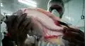 Implantan vagina hecha con piel de tilapia a mujer transexual: el primer caso de Colombia