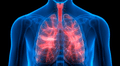 Fibrosis pulmonar: ¿Qué le sucede al órgano cuando se presenta la enfermedad?