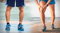 ¿Por qué algunas personas tienen las piernas arqueadas?