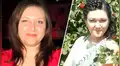 Mujer con el rostro carcomido debido a extraña enfermedad ruega por un diagnóstico [FOTOS] 