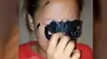 Facebook: muchacha asiática deseaba lucir como estrella K-Pop y se termina 'desfigurando' el rostro