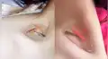 Facebook: el peligroso reto de colocarse peces en la clavícula para probar delgadez [VIDEO]