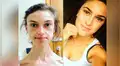 En Instagram, joven vence anorexia y su radical cambio sorprende a miles [FOTOS]