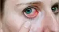 Se le irrita un ojo y doctor encuentra gusanos parásitos en su interior [FOTOS] 