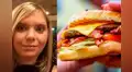 Joven comenta cómo cambió su vida tras dislocarse la mandíbula comiendo una hamburguesa