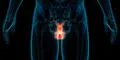 Uno de cada siete hombres padece cáncer de próstata 