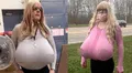 Suspenden a profesora por supuesta prótesis gigante de senos: alega tener gigantomastia