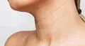 ¿Por qué aparecen líneas en el cuello y cómo atenuarlas?