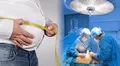 ¿Cuánto cuesta en promedio hacerse la manga gástrica en Perú y qué riesgos tiene esta cirugía?