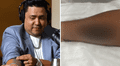 Lucho Cuéllar se hizo tatuaje en honor al Grupo 5 y reaccionan: "Ni Christian Yaipén"