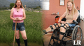 Chloe Jennings-White, la científica que busca la amputación de sus piernas sanas debido a una condición