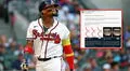 ¿Ronald Acuña Jr. superará su lesión?: este fue el llamativo análisis de médico especialista
