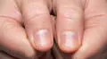 ¿Tus uñas tienen rayas? Descubre su significado y qué puedes hacer al respecto