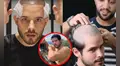Andrés Vílchez se RAPA el pelo para una cirugía y deja a usuarios en SHOCK: "Ya no hay vuelta atrás"