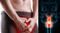 Casos de cáncer de pene aumentan en el mundo: estos son sus síntomas y así se puede prevenir, según expertos