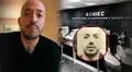 Peruano sufre inconveniente por su alopecia al renovar su DNI y tuvo que recibir ayuda: "Puede ser un caso de estudio"