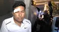 Mototaxista en SJL denuncia que fue asaltado y agredido por fiscalizadores: “Me tiraron al suelo y perdí la conciencia"