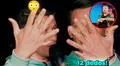 Peruano sorprende al revelar en show de Hablando Huevadas que tiene 6 dedos en cada mano y pies: “Es un X-Men”