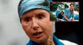 El impactante caso de Charla Nash, la mujer que fue atacada por un chimpancé que le desfiguró el rostro: arrancó labios, nariz y párpados