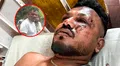 La 'milagrosa' historia del único sobreviviente del accidente de Air India: "No sé cómo estoy vivo"