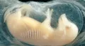 Científicos de China crean corazones con células humanas en embriones de cerdo: un avance clave para los futuros trasplantes