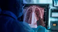 Científicos desarrollan una inteligencia artificial que detecta tumores con la precisión de un médico