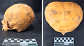 Arqueólogos resuelven el misterio de un cráneo con presunto aspecto ‘alienígena’ encontrado en Sudamérica