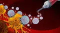 La inmunoterapia en etapas tempranas del cáncer mejora la supervivencia y cambia el enfoque del tratamiento oncológico, según estudios científicos