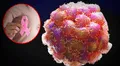 Científicos españoles identifican la proteína que ayuda a las células cancerosas a expandirse a otros órganos: "Son capaces de evadir el sistema inmune"