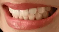 Científicos en Inglaterra descubren un nuevo tratamiento que permite regenerar naturalmente los dientes en adultos