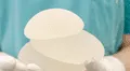 Alerta internacional por implantes médicos prohibidos en Brasil: Digemid continúa evaluando uso de productos en Perú